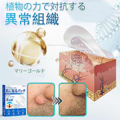 𝐇𝐮𝐝𝐫𝐨𝐬® 📌 𝟐-𝐢𝐧-𝟏 ハイドロコロイドマイクロニードルパッチ｜盛り上がったほくろ、ニキビ、平らなイボおよび皮膚の突起の除去用に特別設計｜9枚入りパッケージ🌱🌱