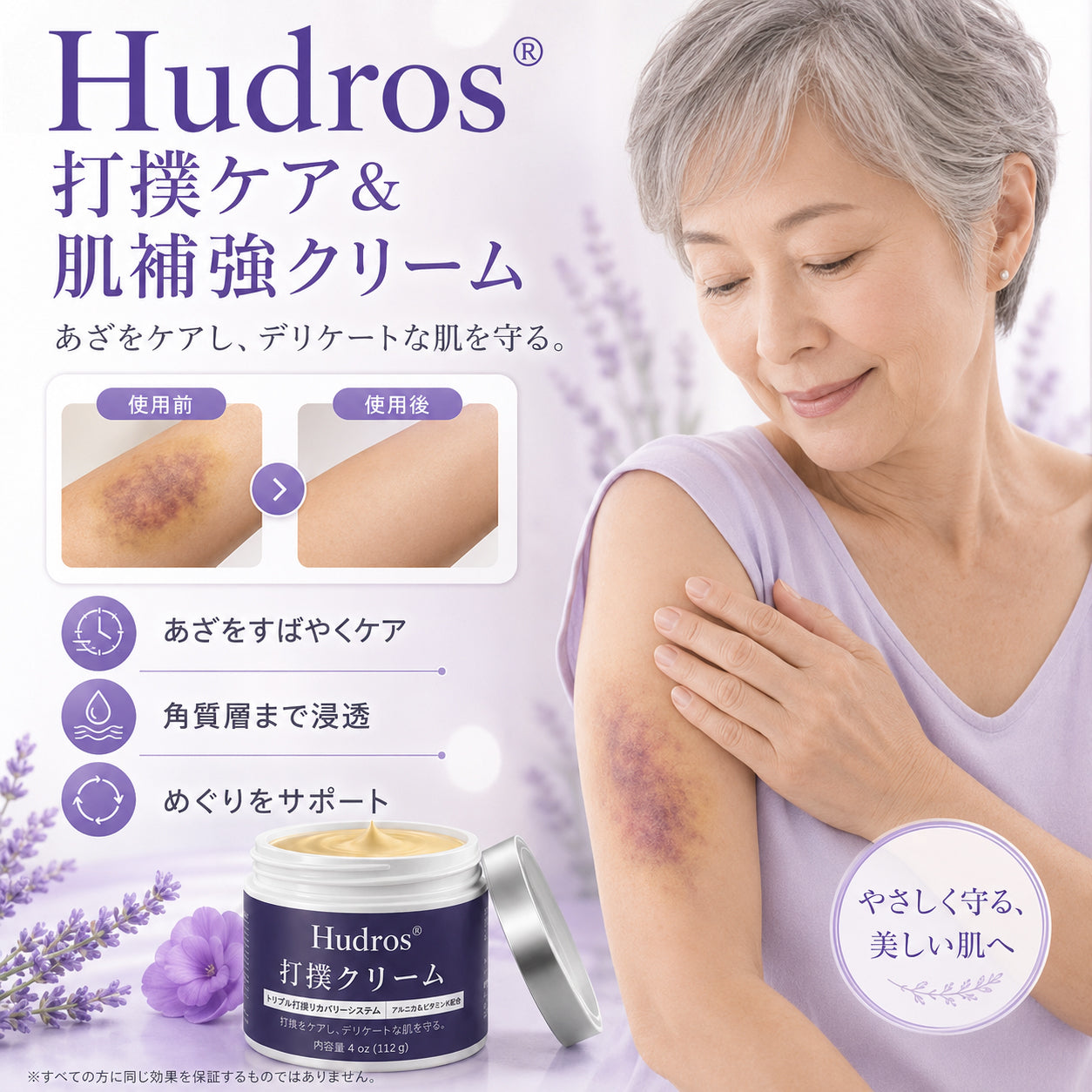 Hudros® あざケア＆肌強化クリーム😃😃1