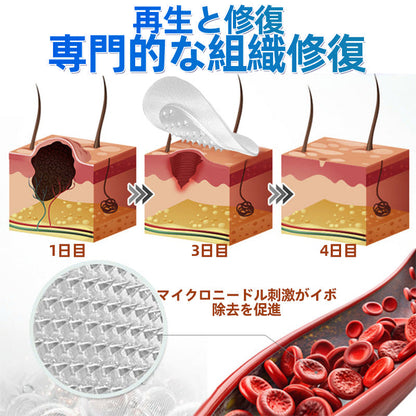 𝐇𝐮𝐝𝐫𝐨𝐬® 📌 𝟐-𝐢𝐧-𝟏 ハイドロコロイドマイクロニードルパッチ｜盛り上がったほくろ、ニキビ、平らなイボおよび皮膚の突起の除去用に特別設計｜9枚入りパッケージ🌱🌱