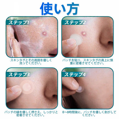 𝐇𝐮𝐝𝐫𝐨𝐬® 📌 𝟐-𝐢𝐧-𝟏 ハイドロコロイドマイクロニードルパッチ｜盛り上がったほくろ、ニキビ、平らなイボおよび皮膚の突起の除去用に特別設計｜9枚入りパッケージ🌱🌱