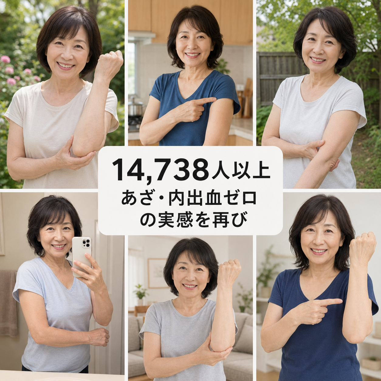 Hudros® あざケア＆肌強化クリーム😃😃1